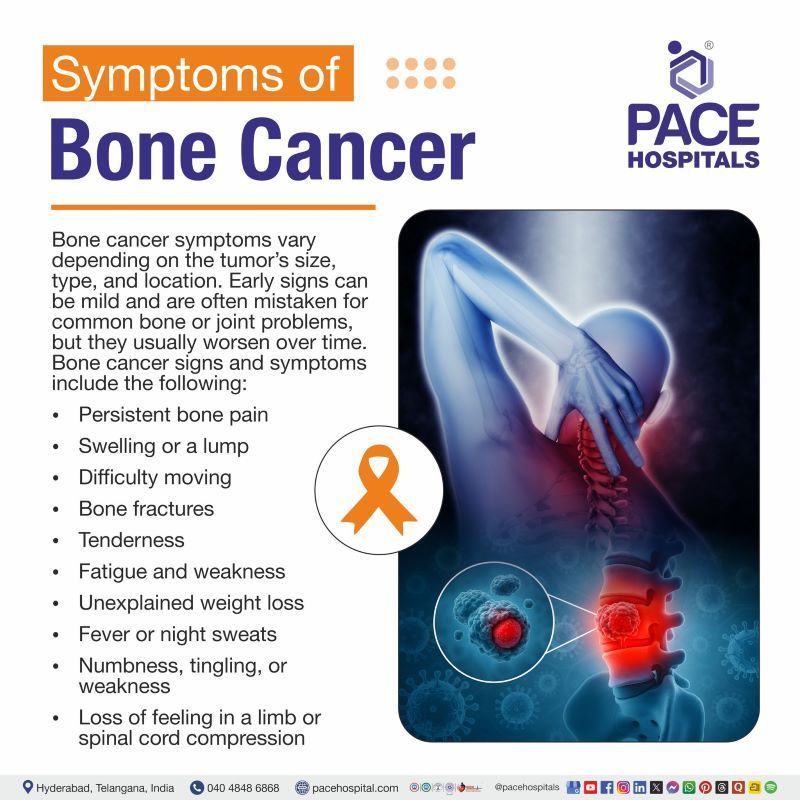 Bone Cancer Symptoms Bone Cancer Symptoms | First symptoms of bone cancer | Bone cancer signs and symptoms | Initial symptoms of bone cancer