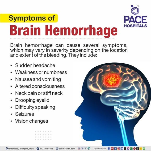 https://lirp.cdn-website.com/69c0b277/dms3rep/multi/opt/Brain%2Bhemorrahge%2BSymptoms%2B-%2BPACE%2BHospitals-640w.jpg
