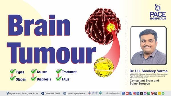 Video of Dr. U L Sandeep Varma from PACE Hospitals explaining brain tumor types symptoms & treatment