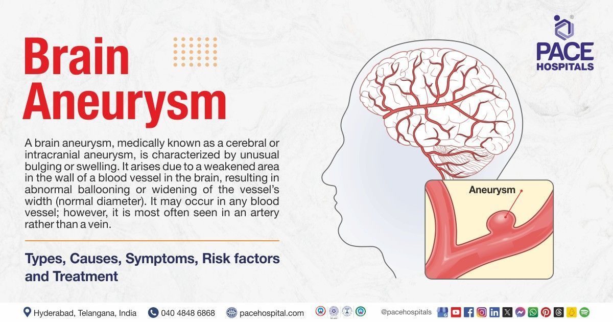 Brain aneurysm symptoms & Cause | Brain aneurysm treatment in India | 
what is a brain aneurysm