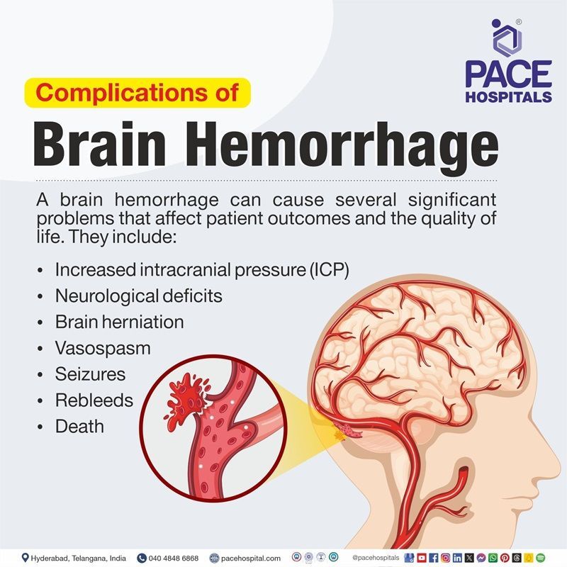 brain hemorrhage complications​
 | chronic complications of brain hemorrhage​ | complications after brain hemorrhage | complications of brain hemorrhage​