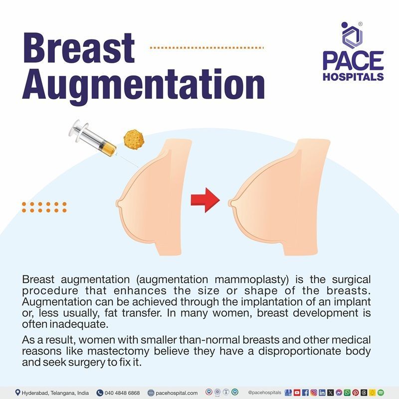 breast augmentation meaning​ | breast augmentation surgery meaning | breast augmentation surgery in India | breast augmentation cosmetic surgery in Hyderabad | breast augmentation surgery price