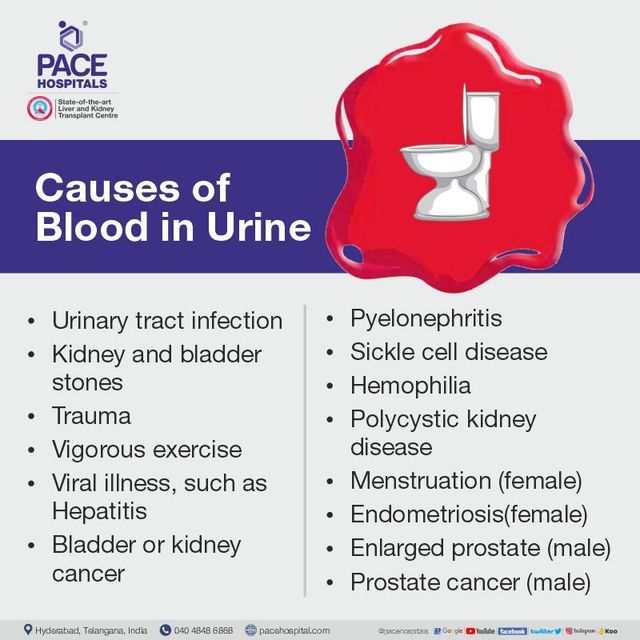 Blood in urine (Hematuria) - Causes, Symptoms and Treatment