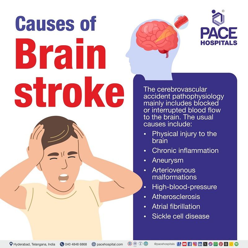 what causes brain stroke | causes of Brain stroke | brain stroke causes | Visual indicating the causes of Brain stroke and an individual experiencing brain stroke