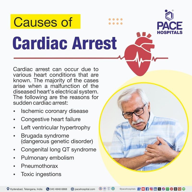 What causes cardiac arrest​ | Visual depicting sudden cardiac arrest causes