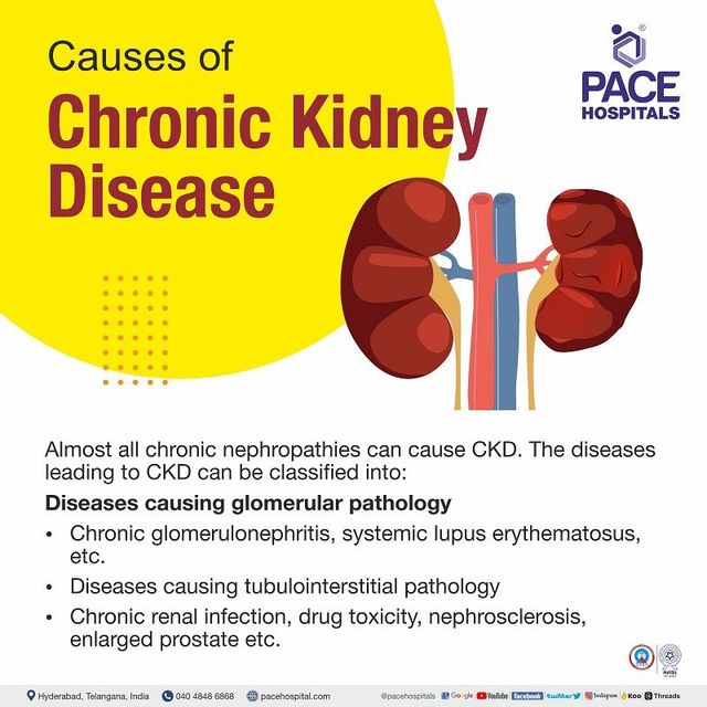 Chronic Kidney Disease Symptoms, Stages, Causes, Risk, 60% OFF