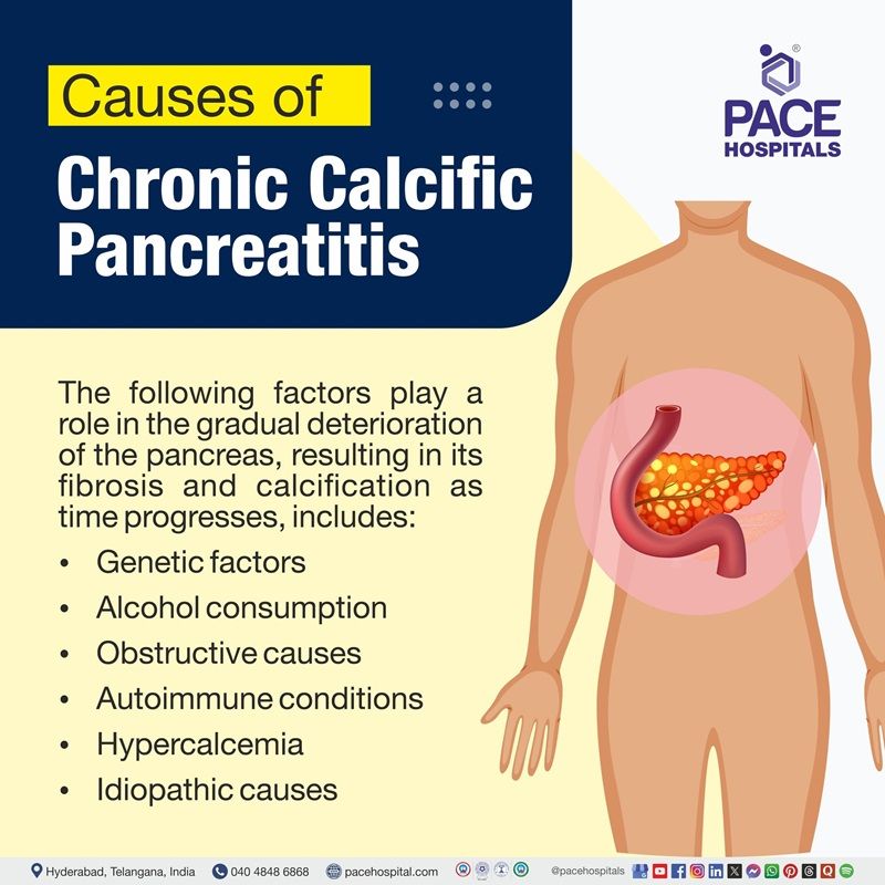 Chronic calcific pancreatitis causes​ | Visual depicting the causes of chronic calcific pancreatitis​