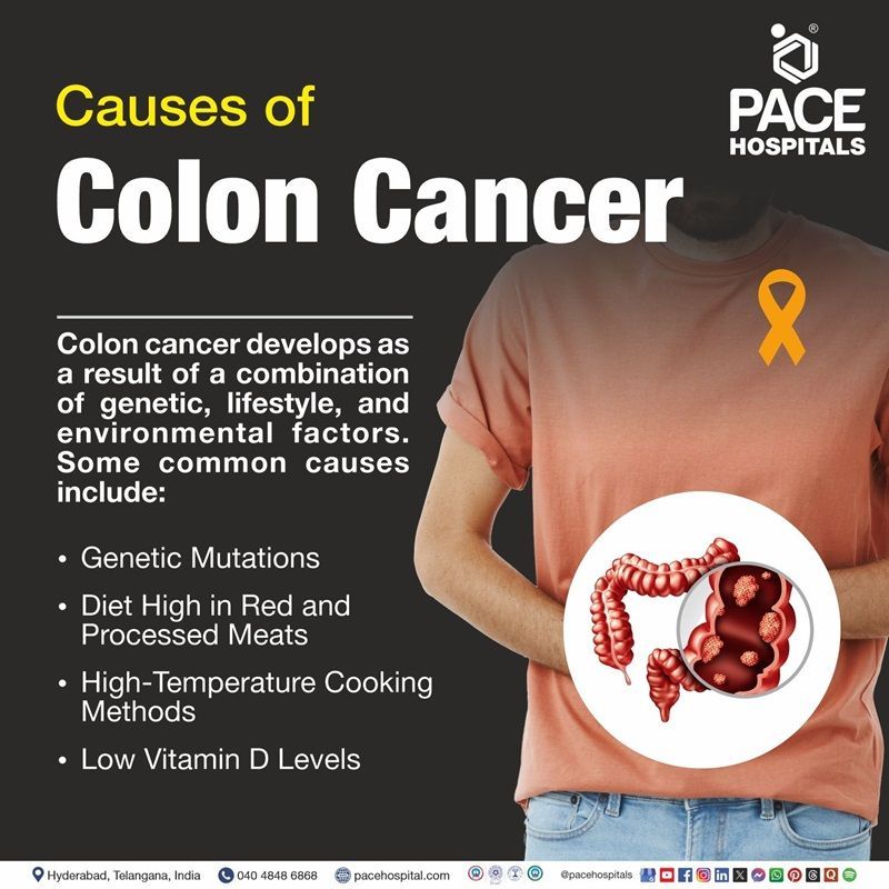 What causes colon cancer | image showing the causes of colon cancer 