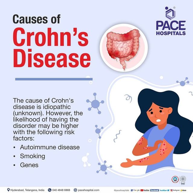 Crohn's Disease - Symptoms, Causes, Complications & Prevention
