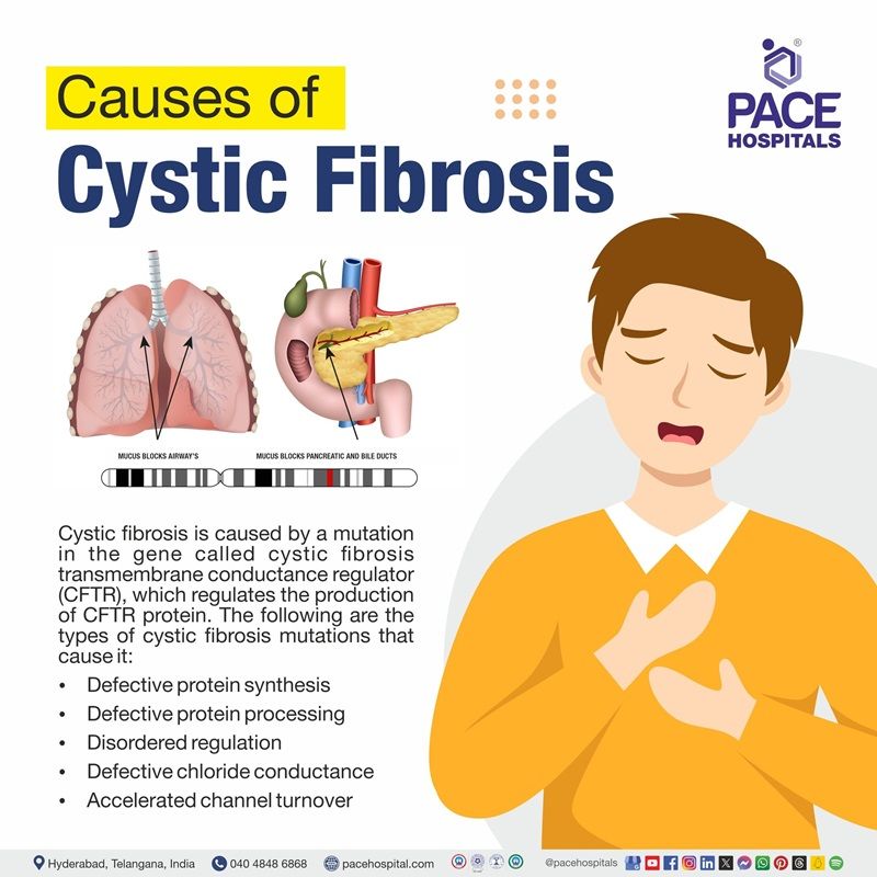 cystic fibrosis causes​ | what causes cystic fibrosis​ | what causes cystic fibrosis and what causes it​ | cause of cystic fibrosis disease​