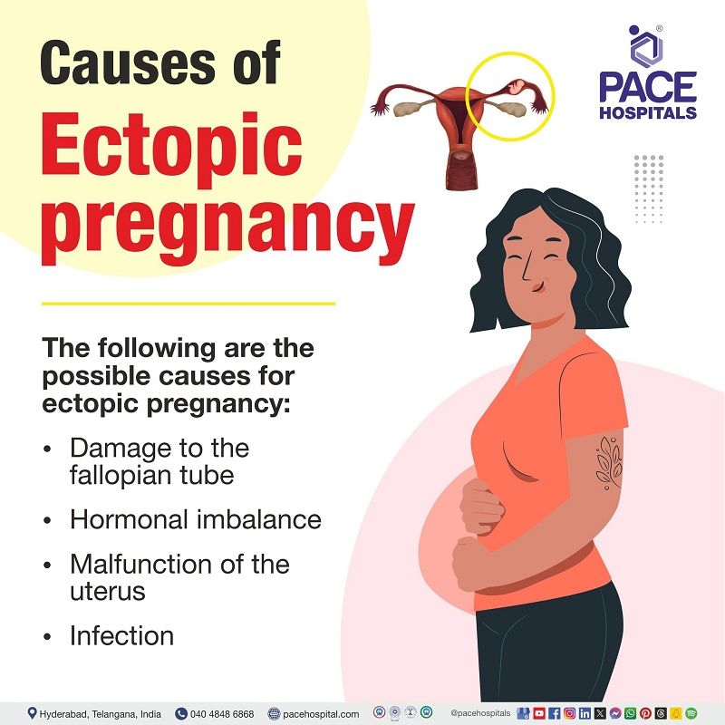 Causes of ectopic pregnancy | What causes ectopic pregnancy | Tubal pregnancy causes |  Woman with ectopic pregnancy | Ectopic pregnancy  possible causes