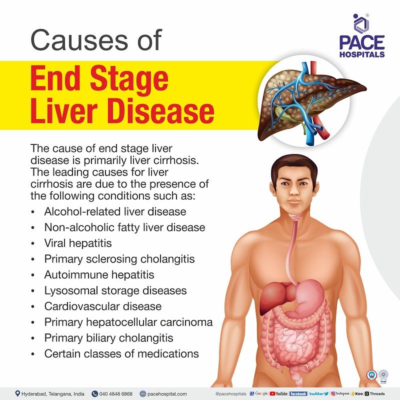 end stage liver disease causes | ESLD causes | end stage liver disease treatment in hyderabad india | pediatric end stage liver disease