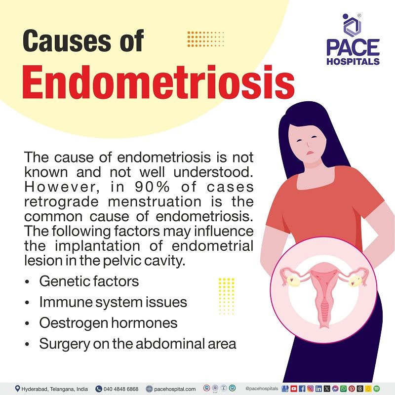 What causes endometriosis symptoms | Endometriosis causes | causes of endometriosis | factors contributing to endometriosis | woman clutching her abdomen indicating pain in the uterus and the text depicting the causes of Endometriosis