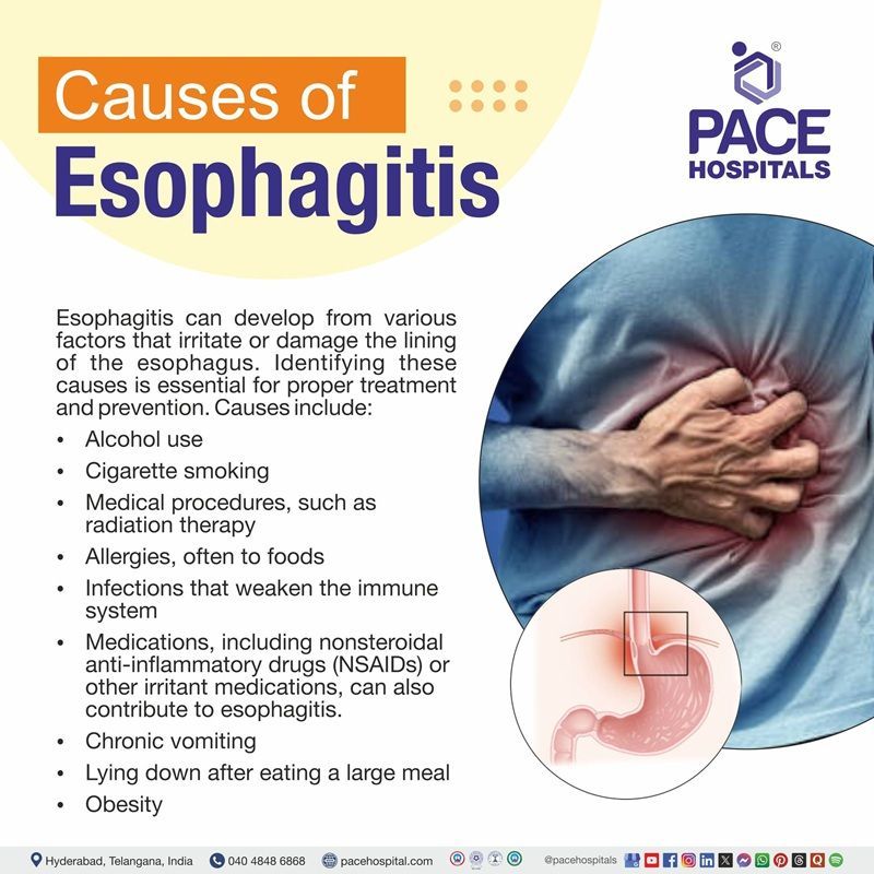 Causes of esophagitis esophagitis causes | causes of esophagitis | common causes of esophagitis | what are the causes of esophagitis in adults