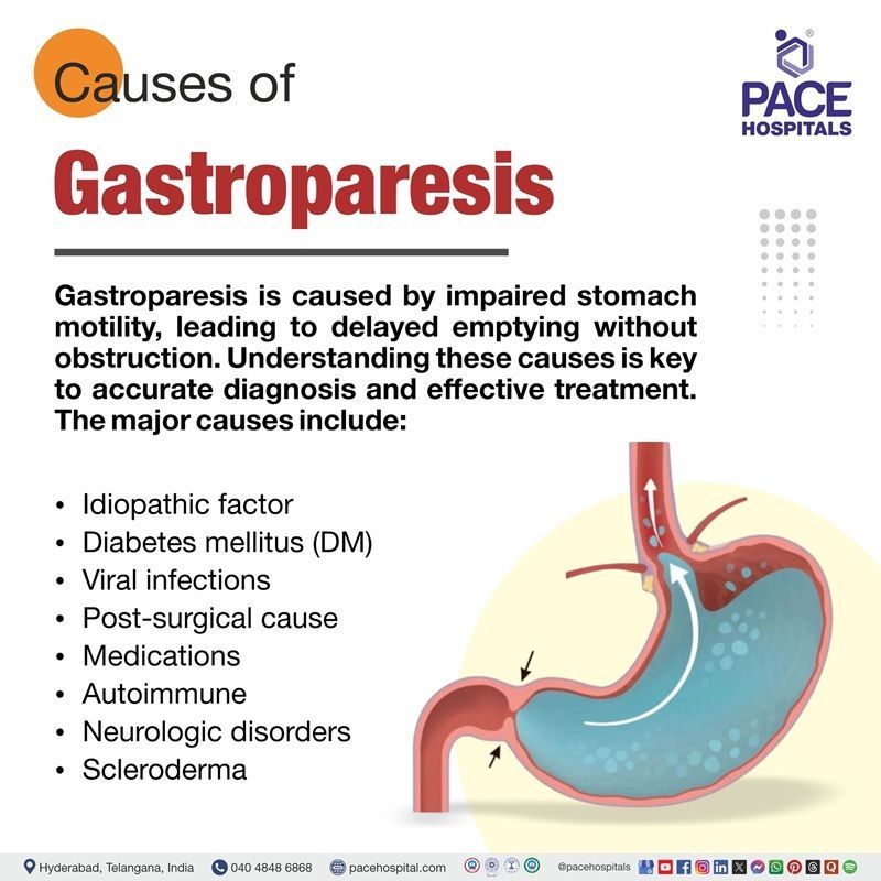 Gastroparesis Causes | 8 causes of Gastroparesis | Gastroparesis Causes | Causes of Gastroparesis