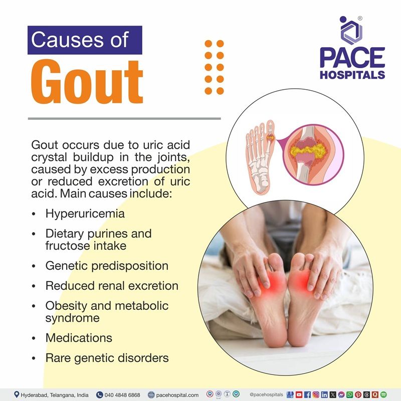 Gout Causes | 9 causes of Gout | Gout Causes | Causes of Gout