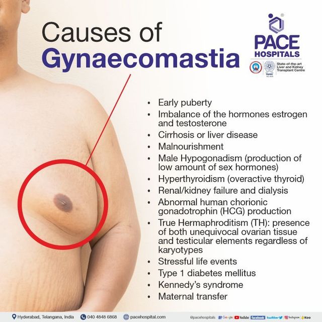 https://lirp.cdn-website.com/69c0b277/dms3rep/multi/opt/Causes+of+Gynecomastia-640w.jpg
