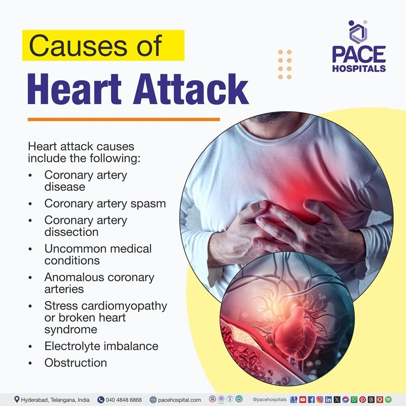 Heart attack causes​ | causes of myocardial infarction​ | image showing the symptoms of Heart attack