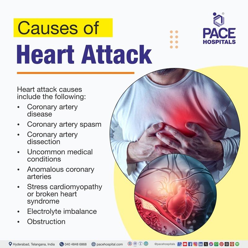 Heart Attack Types Symptoms Causes Treatment Prevention Heart Attack Types Symptoms Causes Treatment Prevention