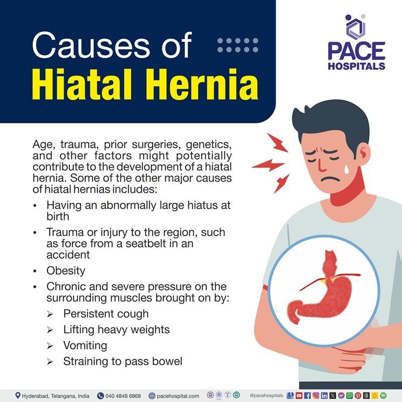 hiatal hernia causes | causes of Hiatal hernia | what are the causes of Hiatal hernia | Visual revealing the causes of Hiatal hernia