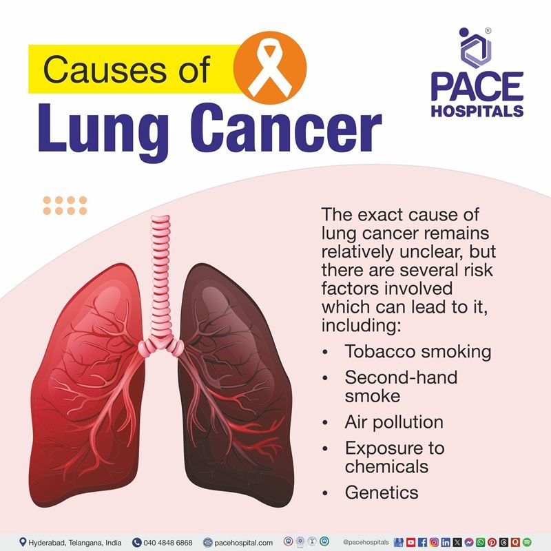 lungs cancer causes | Visual depicting the various causes of lung cancer