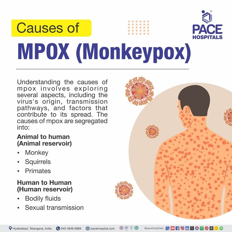 Monkeypox (Mpox) causes | Causes of  Monkeypox (Mpox) | What are the causes Monkeypox (Mpox) | Visual showing the casues of Monkeypox (Mpox)