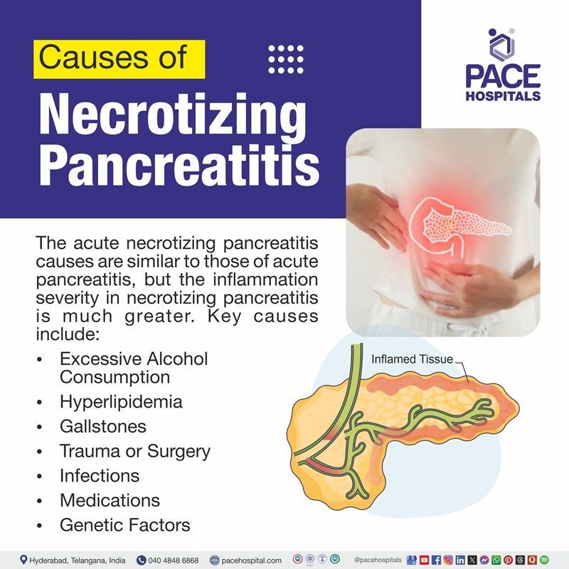 Acute necrotizing pancreatitis causes​ | Image showing necrotizing pancreatitis causes​ 