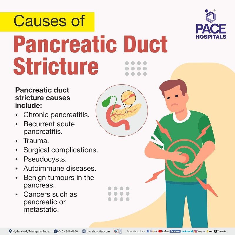 Causes of Pancreatic Duct Strictures | Benign and Malignant Pancreatic Ductal Strictures Causes | Treatment of Pancreatic Duct Stricture