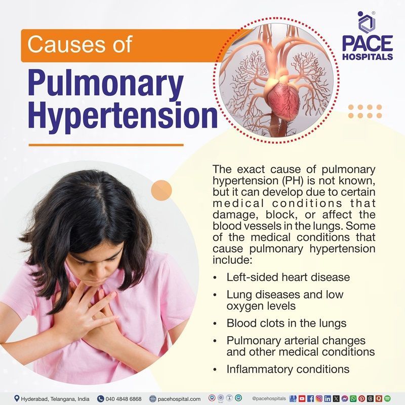 Pulmonary Hypertension Causes Pulmonary hypertension causes | pulmonary arterial hypertension causes