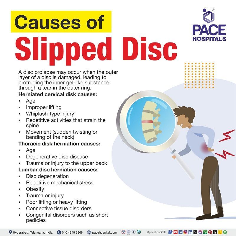 slip disc causes | what causes a slipped disc | herniated disc causes | what causes a herniated disc | lumbar disc herniation cause | Visual depicting the causes of Slipped disc and a person affected with disc herniation