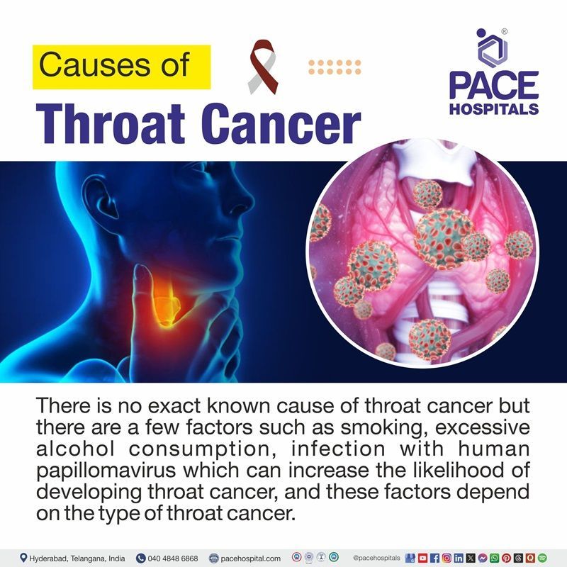 what causes throat cancer​ | image showing the cause of throat cancer