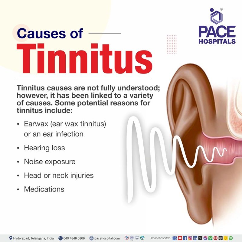 tinnitus causes | pulsatile tinnitus causes | objective tinnitus causes | Causes of Tinnitus | What are the causes of tinnitus | Visual depicting the causes of Tinnitus
