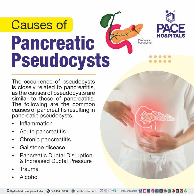 Pancreatic pseudocyst causes | image displaying the causes of Pancreatic pseudocyst