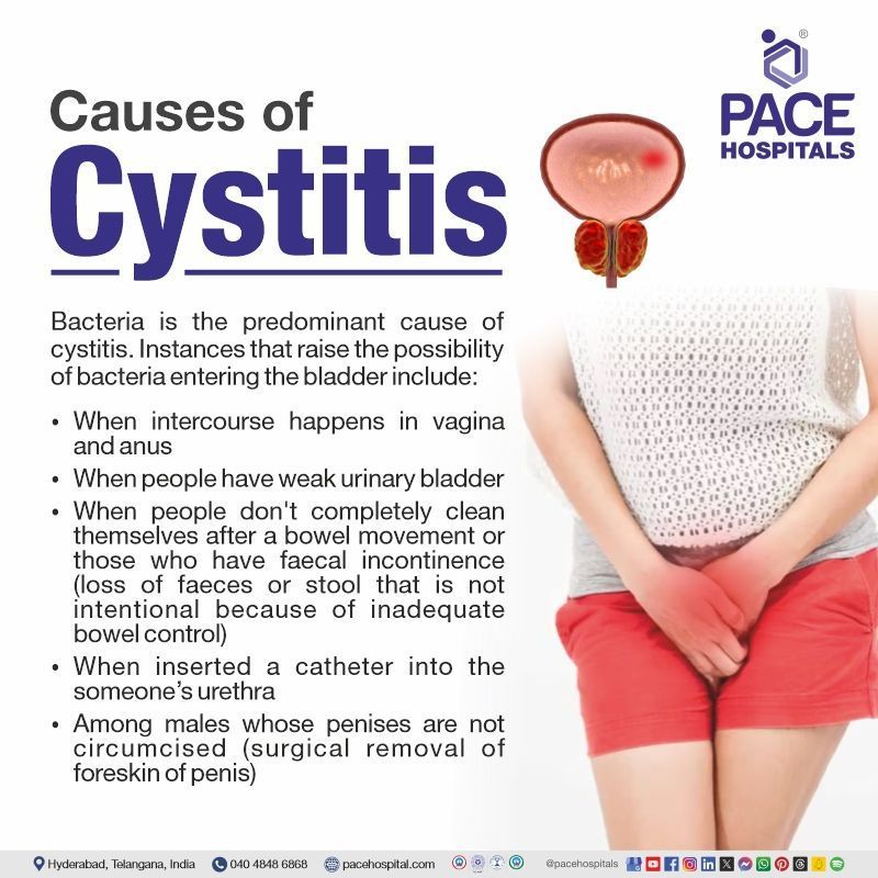 Cystitis causes | cystitis causes in female | interstitial cystitis causes | What causes cystitis | Visual revealing the causes of Cystitis