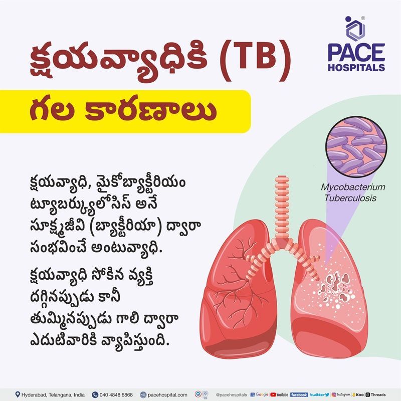 causes of tb in telugu language | causes of Tuberculosis in telugu language | Tuberculosis causes in telugu | TB causes in telugu