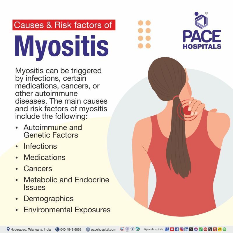 Causes and Risk Factors of Myositis Causes and Risk Factors of Myositis | Myositis causes | Myositis risk factors | Causes of myositis | Risk factors of myositis