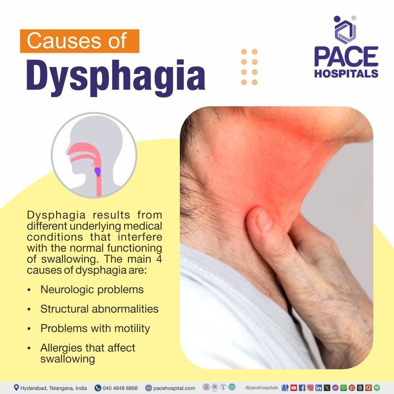 Dysphagia Causes Dysphagia Causes | 4 causes of Dysphagia | Dysphagia Causes | Caues of Dysphagia