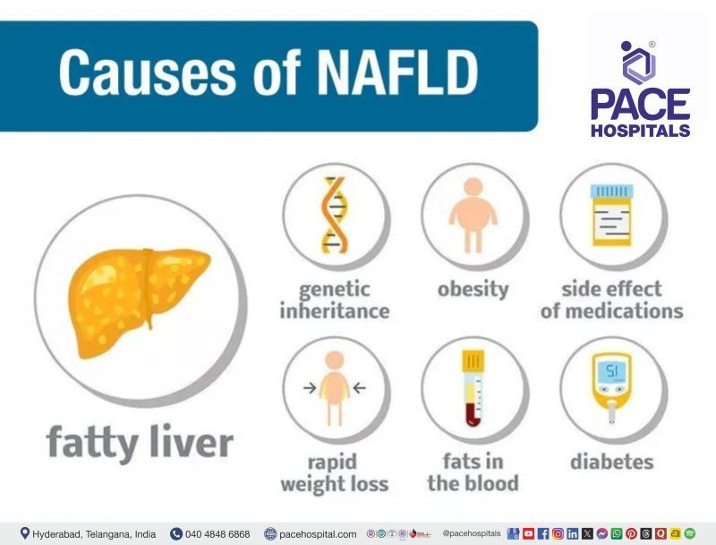 non-alcoholic fatty liver disease causes nafld causes - non alcoholic fatty liver disease