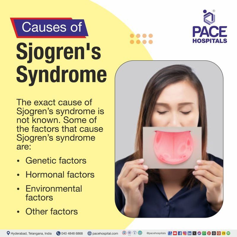 Causes of Sjogren's Syndrome Causes of sjogren's syndrome disease | cause of sjogren's syndrome | sjogren's syndrome cause | what causes sjogren's syndrome