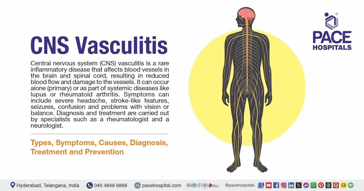Central Nervous System Vasculitis Symptoms, Causes, Types, Diagnosis & Treatment | CNS Vasculitis