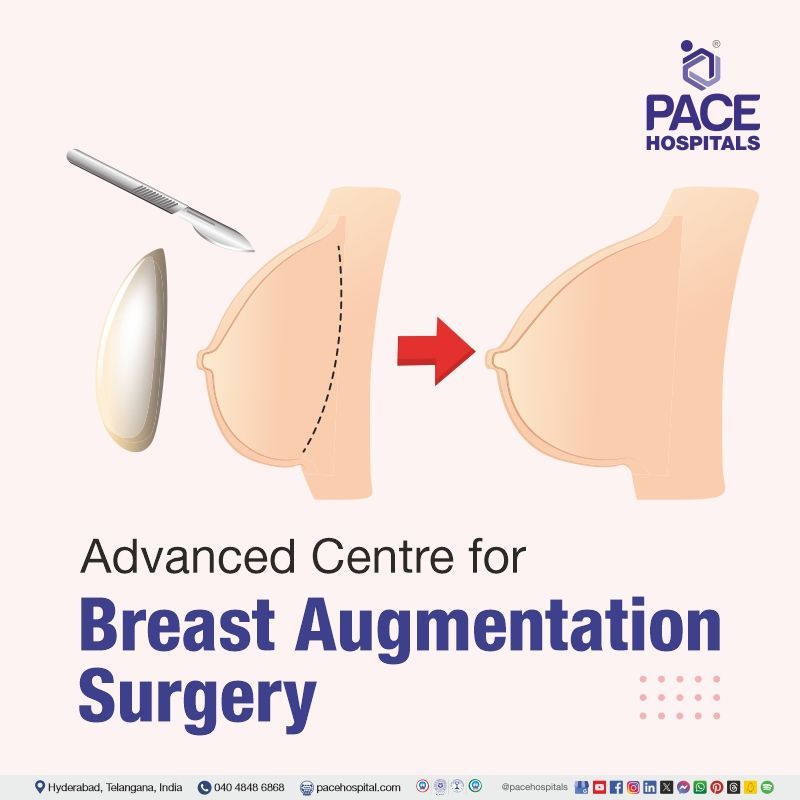 Best Hospital for Breast Augmentation Surgery in Hyderabad India | best breast augmentation surgery hospital in Hyderabad | breast augmentation surgery near me