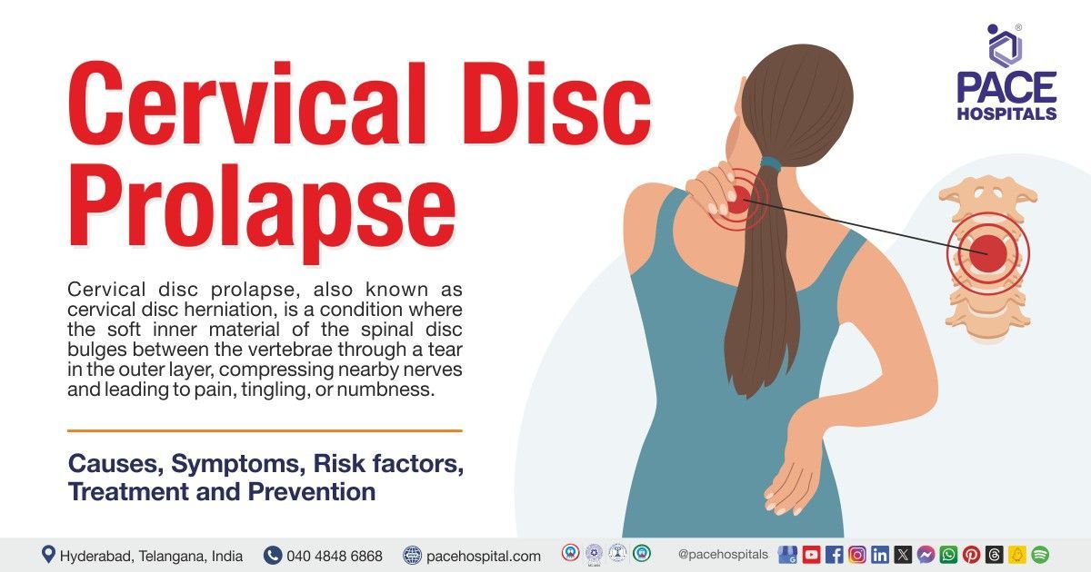 cervical disc herniation | disc prolapse treatment in India | Cervical disc prolapse
