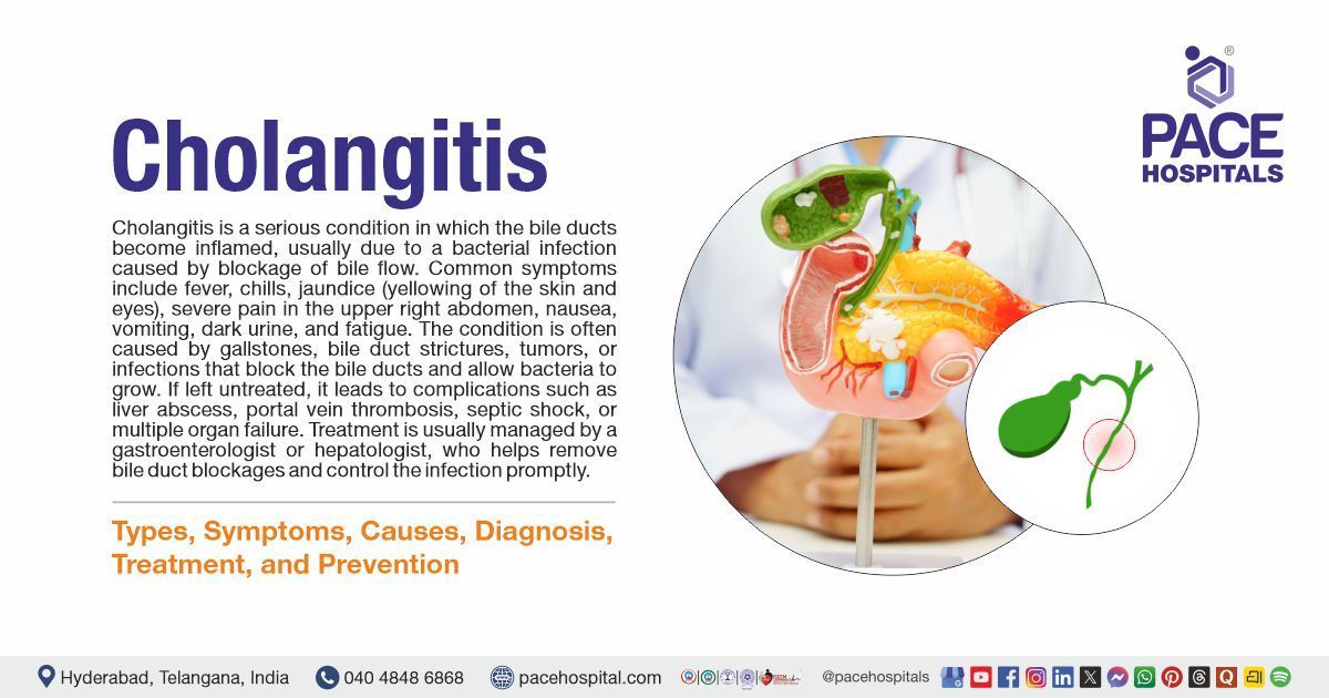 Cholangitis Symptoms, Causes, Types, Diagnosis, Treatment & Prevention | What is Cholangitis