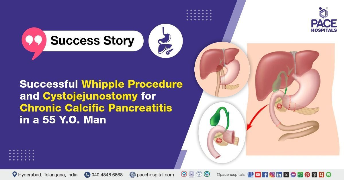 Case study of a patient with chronic calcific pancreatitis treated at PACE Hospitals, Hyderabad
