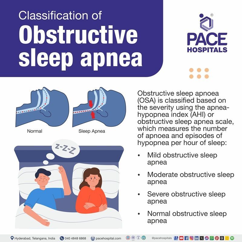 obstructive sleep apnea classification​ | classification of obstructive sleep apnea | multimodal classification of obstructive sleep apnea | Visual showing the classification of obstructive sleep apnea
