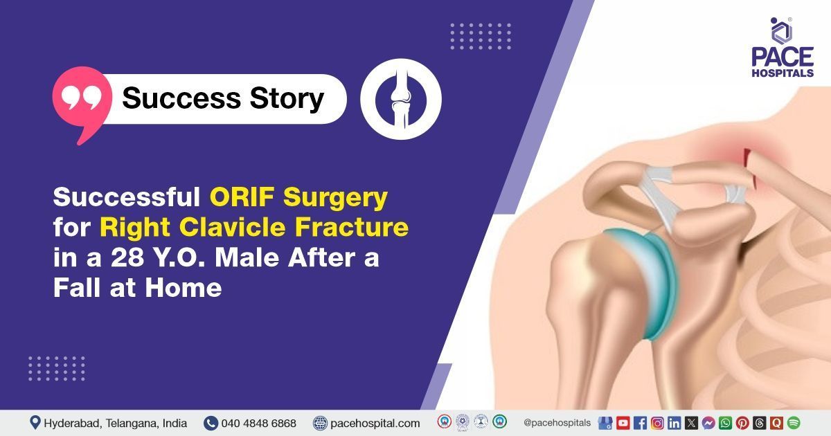 Case study of a 28-year-old male with a clavicle fracture, successfully treated at PACE Hospitals