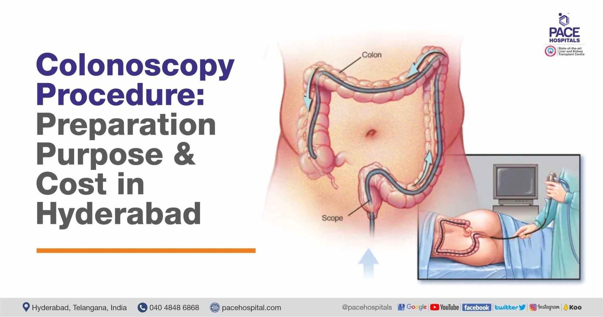 colonoscopy scope