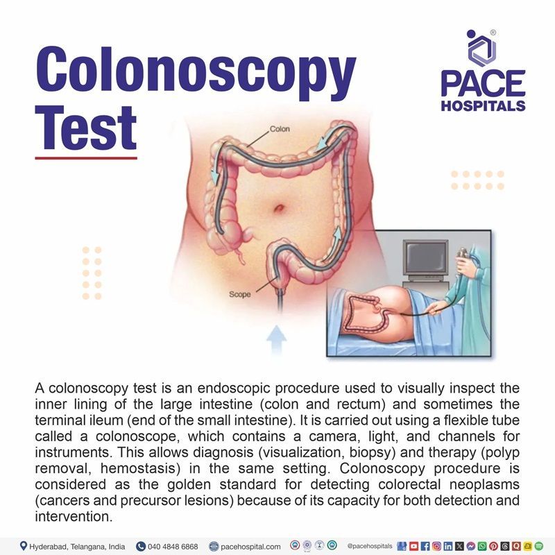 Colonoscopy Meaning What is a colonoscopy | colonoscopy meaning | What is colonoscopy test