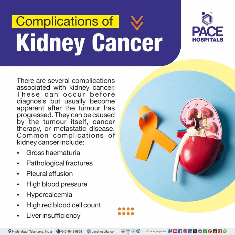 Kidney cancer complications | Diagram illustrating the complications of Kidney cancer