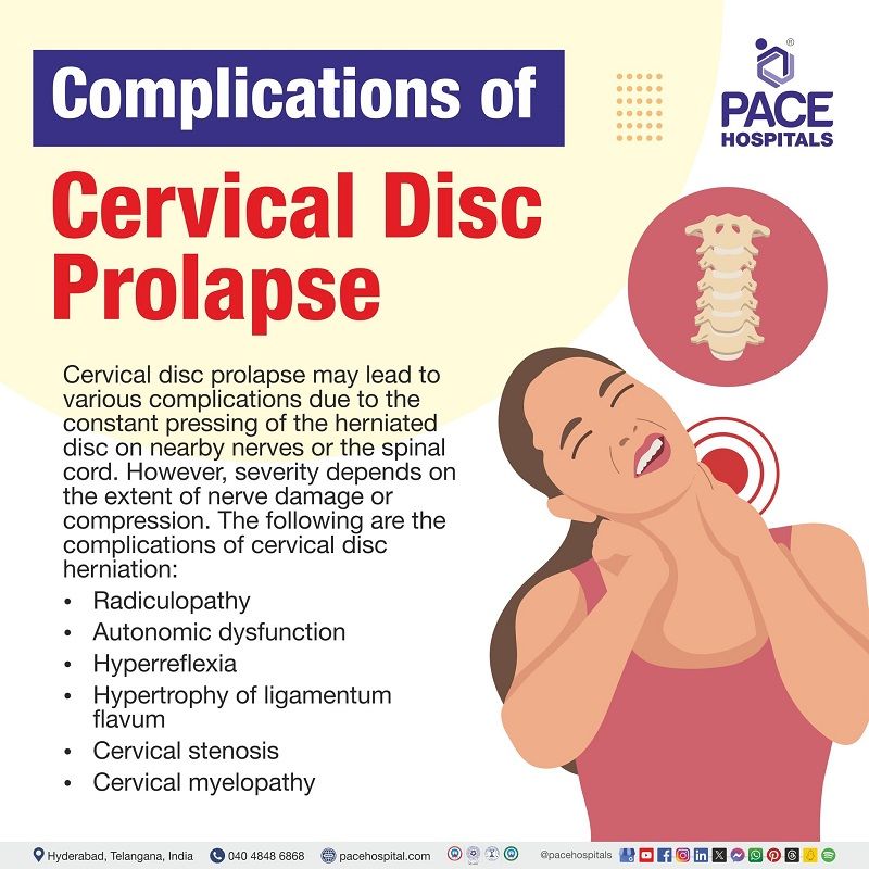 Cervical disc prolapse complications |  | Cervical disc herniation complications |  complications of Cervical disc herniation| Disc prolapse  complications | Visual revealing the complications of Cervical disc prolapse 